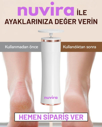 Nuvira - Ayak Törpü Cihazı